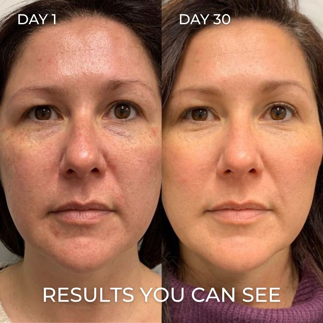 PDRN Collagen Balm