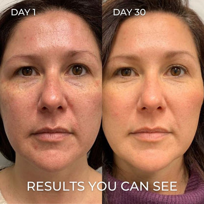 PDRN Collagen Balm