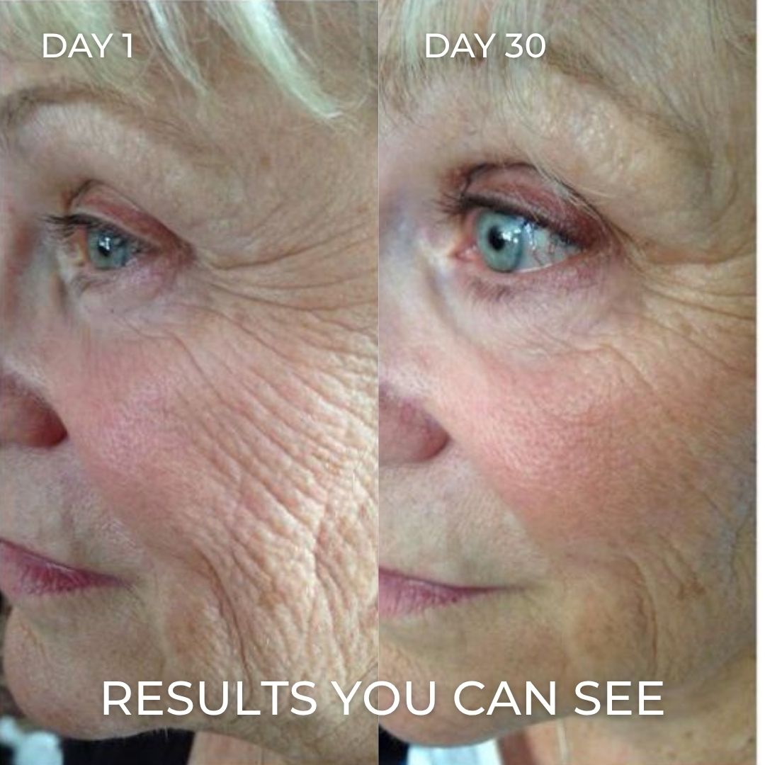 PDRN Collagen Balm